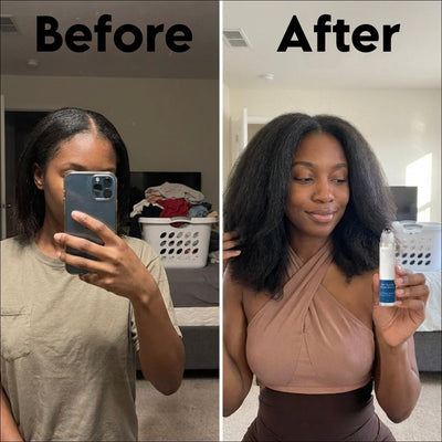 Advanced Hair Growth Serum - Skinism