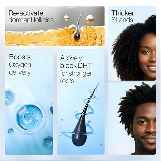 Advanced Hair Growth Serum - Skinism