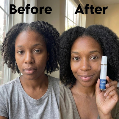 Advanced Hair Growth Serum - Skinism